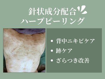 プライベートエステサロン トゥインクル/針状成分配合ハーブピーリング☆