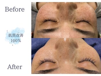 ディアスマイル(Dear.smile)/肌質改善100％