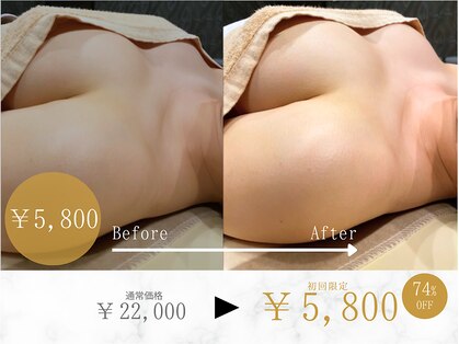 ルルミリ 心斎橋(Lulumili)の写真