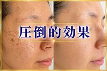 ボーテヌール(Beaute Nheur)