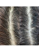 シュール センター南(SURREAL)/ヘッドスパ後のビフォーアフター