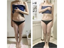 エクラ(Eclat)/ブライダル/小顔/毛穴/美白肌