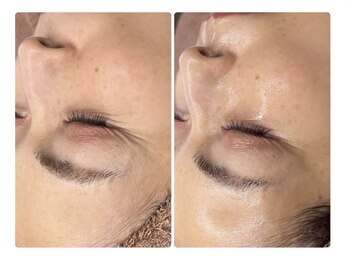 エイミー 名古屋駅前店(eimy.)/ララピール/名古屋