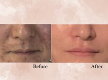 ハナチュチュ 矢場町店(Hanachuchu)/