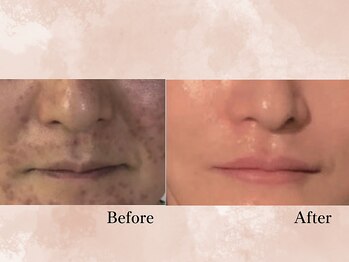 ハナチュチュ 矢場町店(Hanachuchu)/