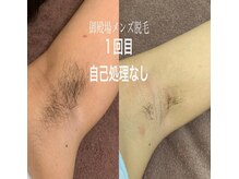 ルルアス(LuLu AS)の雰囲気(ハイスペック脱毛機で丁寧な施術★サロン選びに不安は要らない)