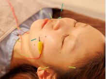 アネラ鍼灸整体院(Anela鍼灸整体院)/贅沢時間の美容鍼を体験ください