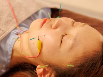 アネラ鍼灸整体院(Anela鍼灸整体院)/贅沢時間の美容鍼を体験ください