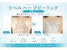 【魅せたくなる背中へ】背中ニキビケア★リベルハーブピーリング（剥離あり）