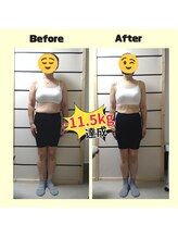 きぼう鍼灸整骨院/ダイエット整体３ヶ月プログラム