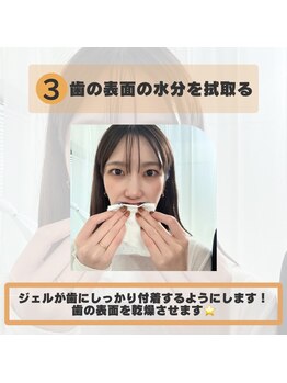 ホワイトニングショップ 福岡姪浜店/セルフホワイトニングのやり方