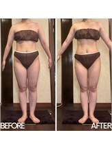 アーユルヴェーダアンドアロマエステ アユス(AYUS)/デコルテと足もスッキリ