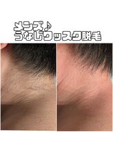 トリニティスペース(TrinitySpace)/メンズもうなじ(襟足)ワックス☆