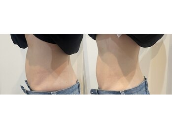 ルナート(Lunart)/【腸もみ】でぽっこり解消