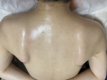 ダルセーニョ/美しい肩甲骨は健康への一歩です