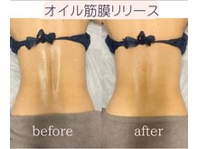 藍/オイル筋膜リリース