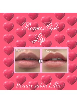 ベイビースキン(Baby skin)/ローマピンクBefore→After