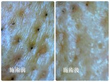 キーオブフェイス(Key of Face)/お悩み【お顔のくすみ】