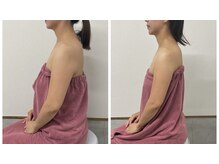 ブリランテ(Brillante)/