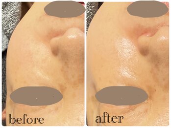 ニュイ(nuit)/プラピール1回目