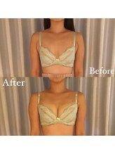 サロン ド ガーネット(Salon de Garnet)/バストアップ☆ビフォーアフター