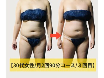 ネオボディ(Neo Body)/サイズダウン