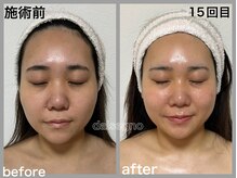 ダルセーニョ/土台の組み上げは結果をだします