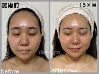ダルセーニョ/土台の組み上げは結果をだします
