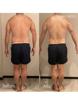 エステティック ミュー(Esthetic MiEUX)の写真/【脱・だらしない体】結果主義のメンズ痩身。腹・腰・背中をまとめて一掃。徹底的に燃やしましょう!