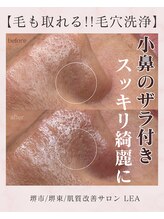 レア(Lea)/小鼻のザラ付き改善＊