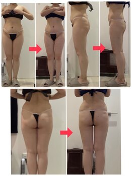 プラチナアース つくば店(Platinum earth)/お腹・太もも裏ビフォーアフター