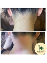 マイレ 銀座(MAILE)/うなじ