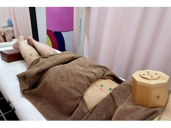 ことぶき整骨院/枡灸 箱灸 鍼