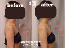 コリ チル(Kori Chill)/【ハイパー Before→After】