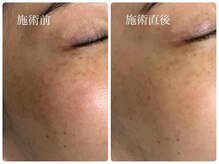 シェミー(CHEZ MEE)/◆72時間◆ シミが定着する前に