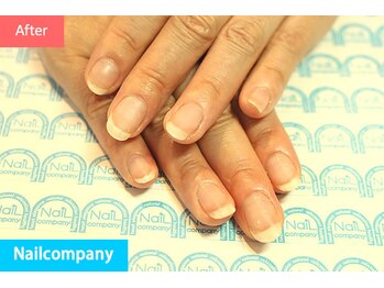 ネイルカンパニー/