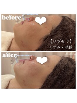 ウィンクドール(Wink Doll)/【リブセラ】