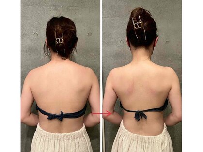 ビノワ(Binowa)の写真