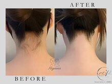 エープラス 心斎橋店(A+)/ひげうな脱毛