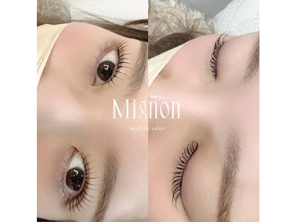 ミニョン(Mignon)の写真