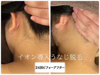 リノ(Lino)/うなじ脱毛シェービング付き♪