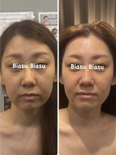 ビアス(Biasu)/頭蓋骨ストレッチ