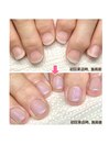 ビフォーアフター