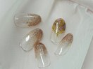 ハンド定額シンプルコース