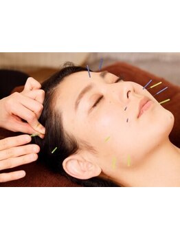 鍼灸施術を受けたい