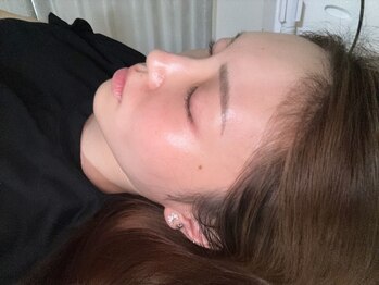 メロウ(mellow)の写真/女性も男性もお顔の脱毛人気急上昇中！自己処理による肌荒れや乾燥から卒業しませんか？自信の持てる素肌へ