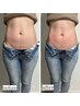 【再来/1ヶ月以内限定】ハイパー筋膜　上半身集中DETOX  60分　12,800円