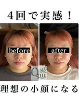 キュープ 鹿児島伊集院店(Qpu)/