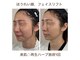 ブルームエイト(Bloom8)の写真