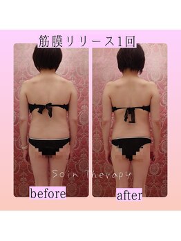 ソワンテラピー(Soin Therapy)/細い方でもここまで変わる